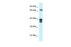 SH3BP1 Antibody, Novus Biologicals 100 &mu;L; Unconjugated:Antibodies,